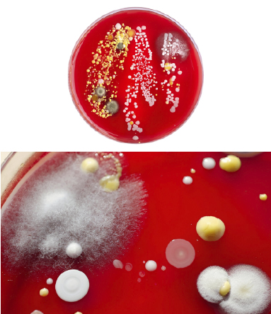 img Bacteriologia y Micologia